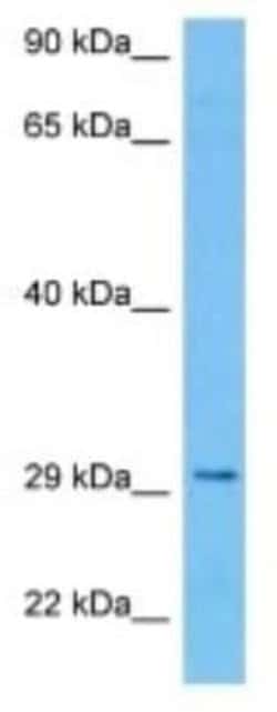 LRTOMT Rabbit anti-Rat, Polyclonal, Novus Biologicals:Antibodies:Primary
